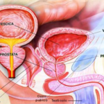 Cosa c'è da sapere sulla prostata